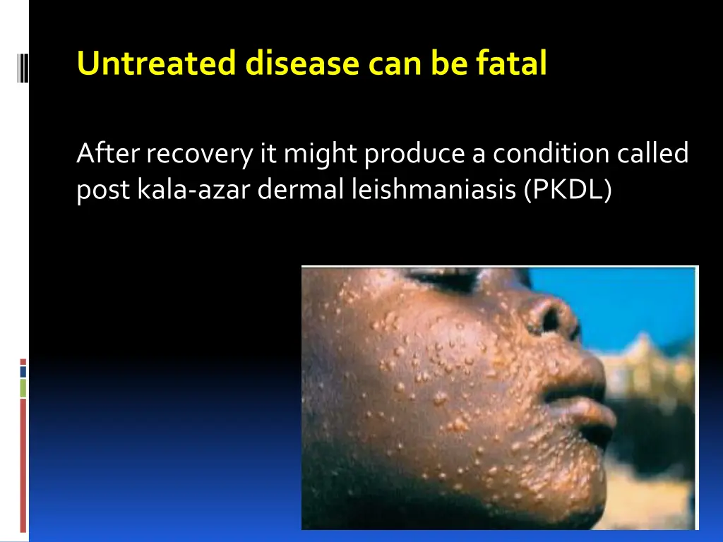 untreated disease can be fatal