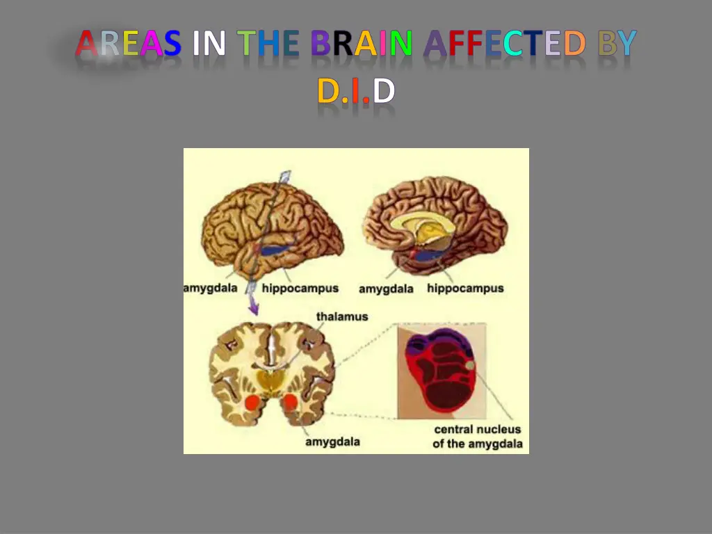 areas in the brain affected by d i d