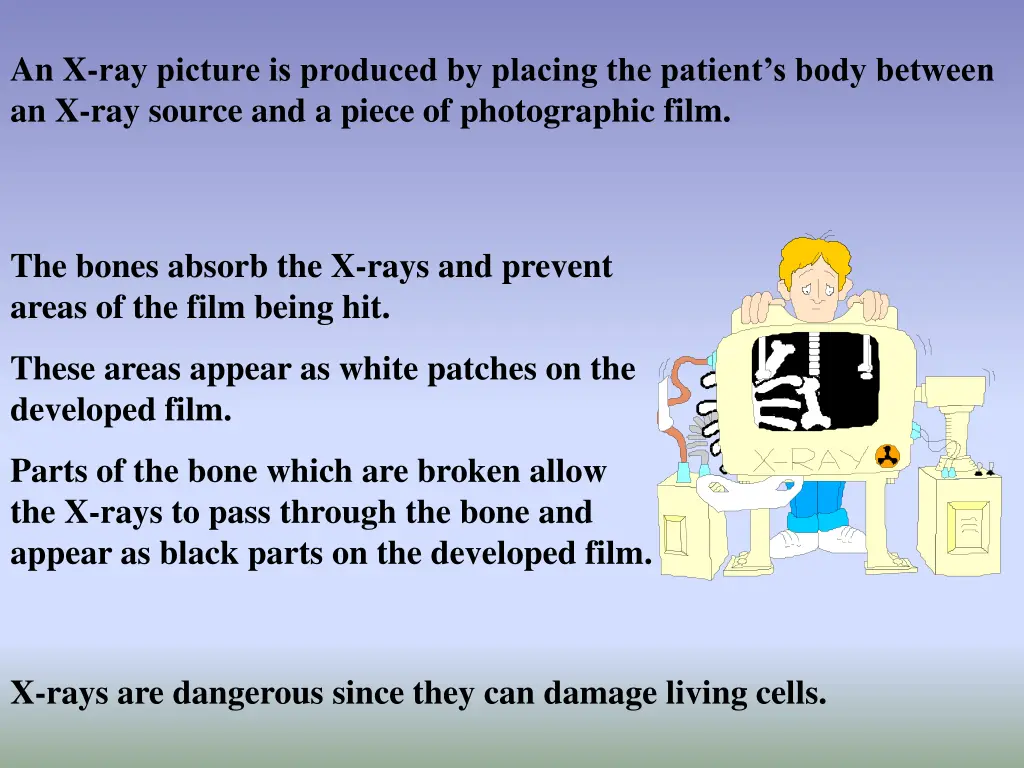 an x ray picture is produced by placing
