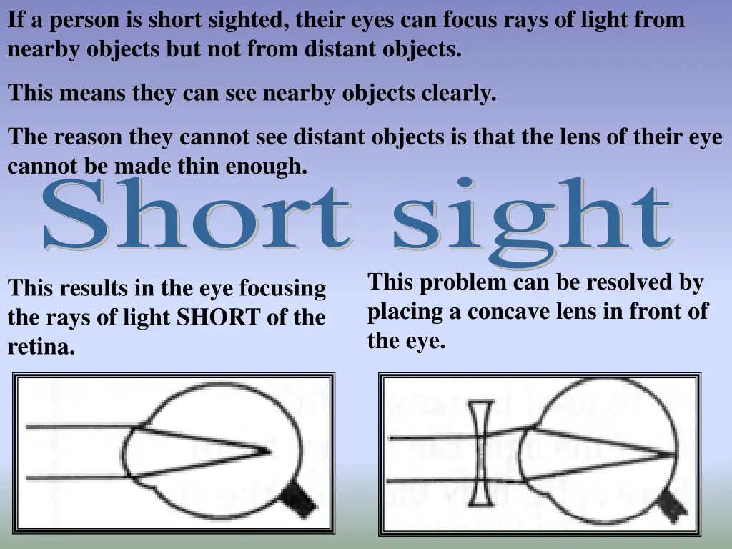 if a person is short sighted their eyes can focus