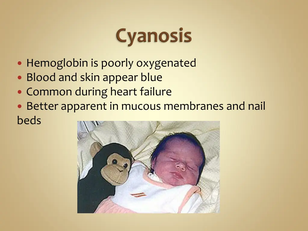 hemoglobin is poorly oxygenated blood and skin