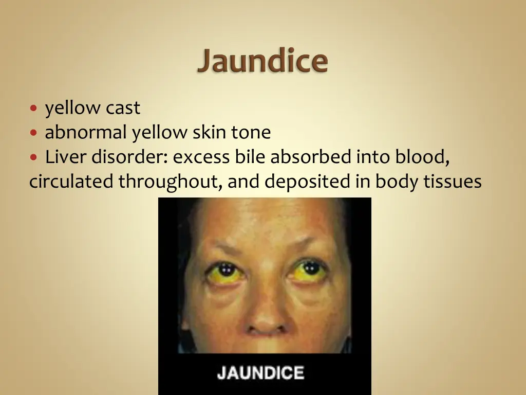 yellow cast abnormal yellow skin tone liver