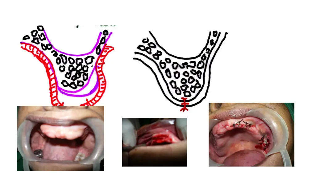 slide12