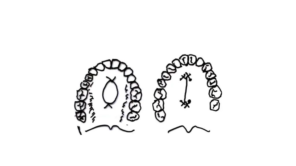 slide16