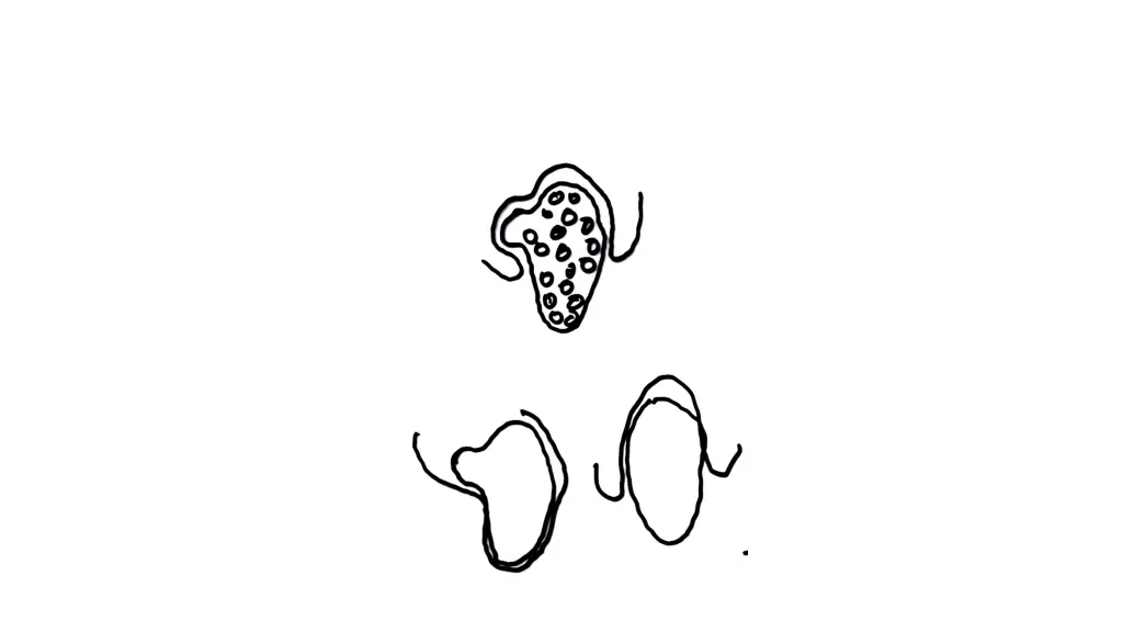 slide17