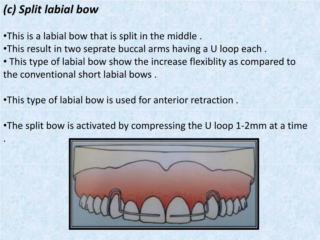 c split labial bow