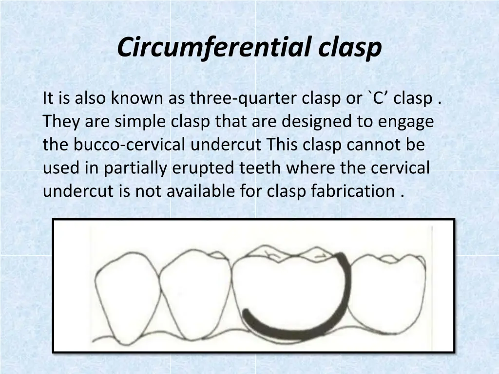 circumferential clasp
