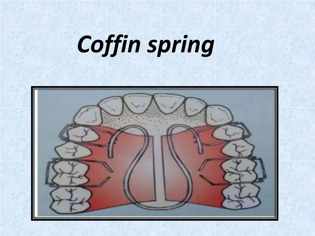 coffin spring 1