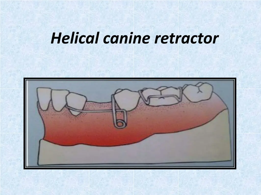 helical canine retractor