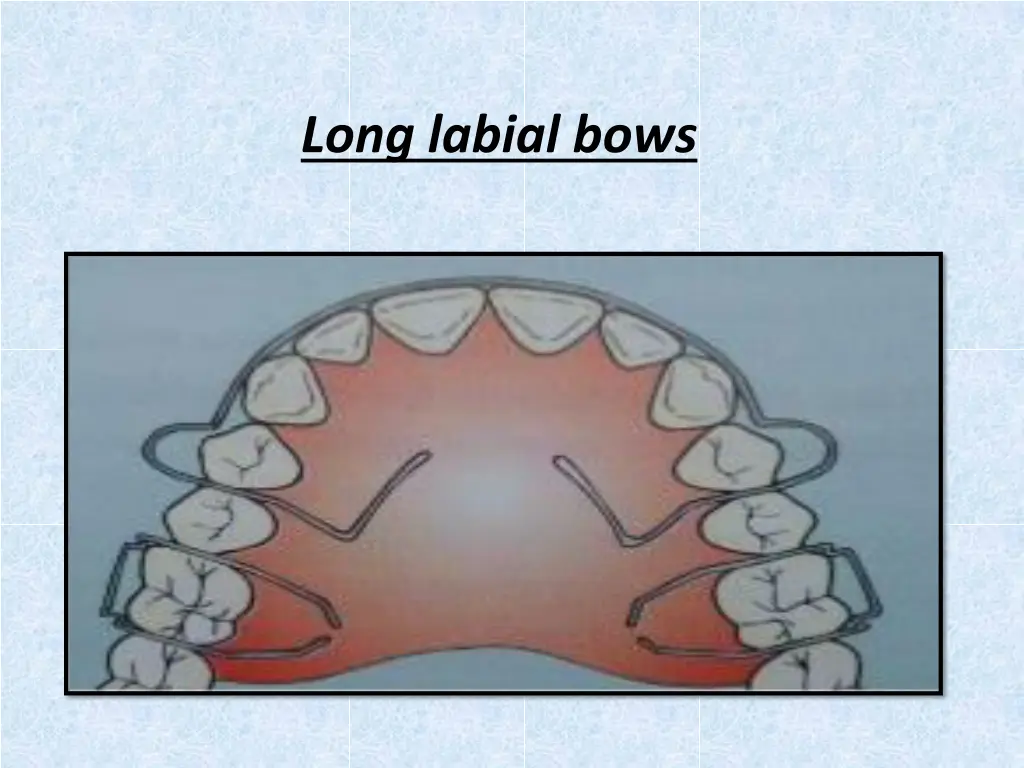 long labial bows