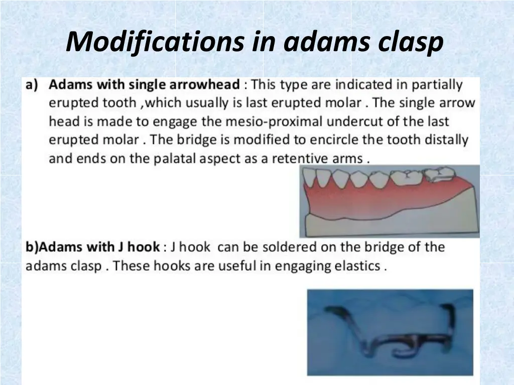 modifications in adams clasp