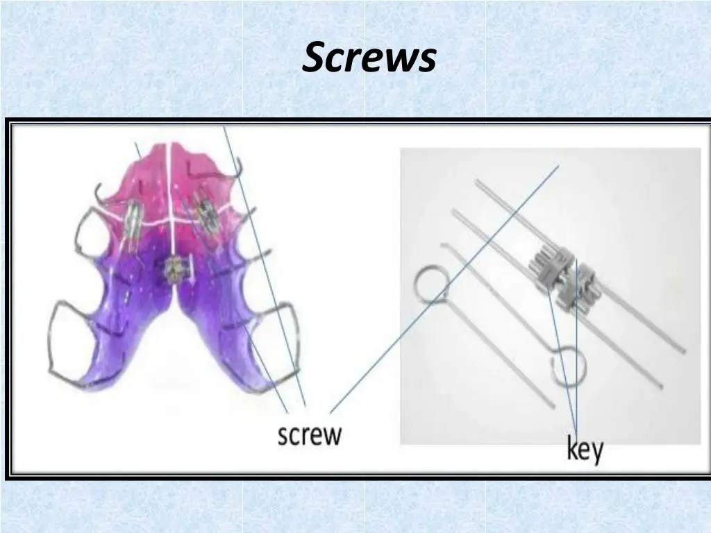 screws 1
