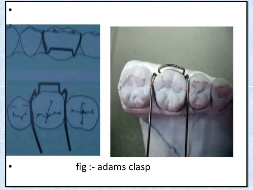 slide14