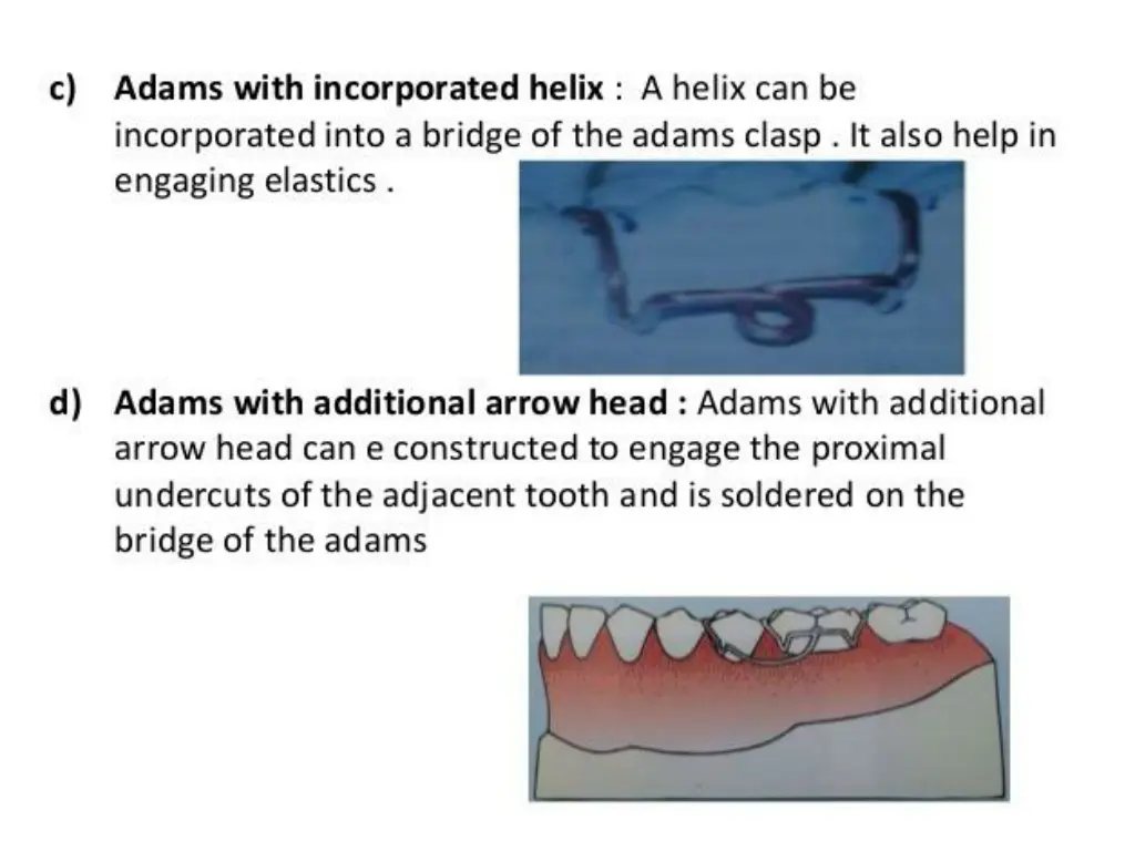 slide17