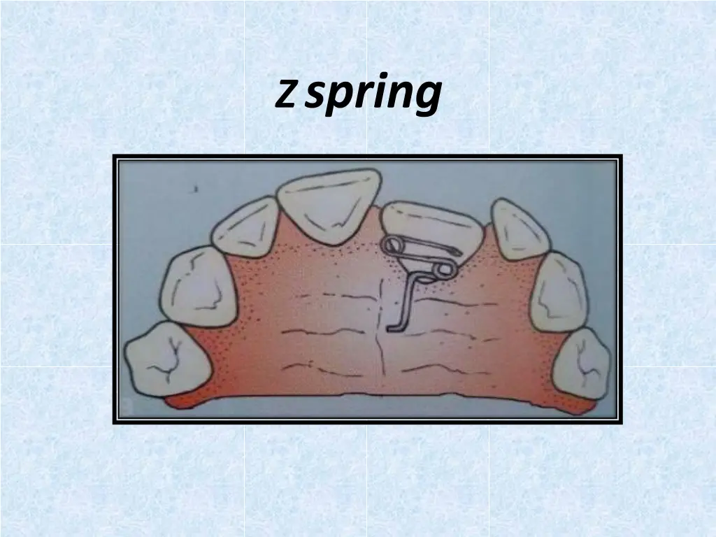z spring 1