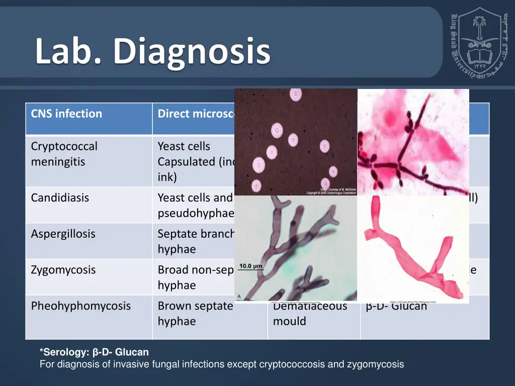 cns infection