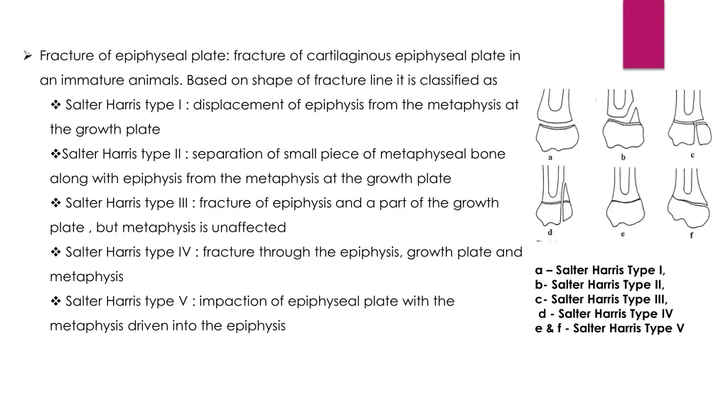 fracture of epiphyseal plate fracture