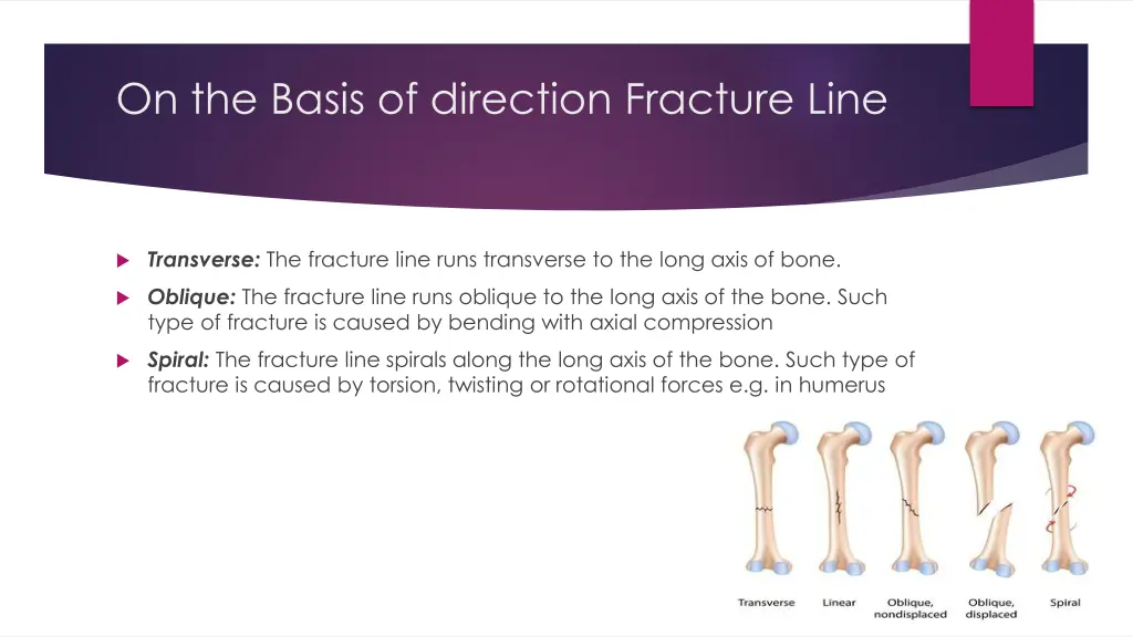 on the basis of direction fracture line