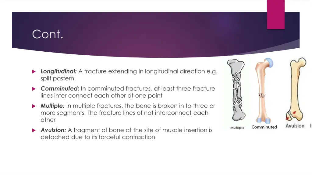 slide3