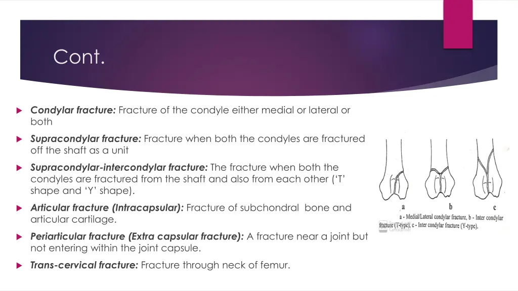slide7
