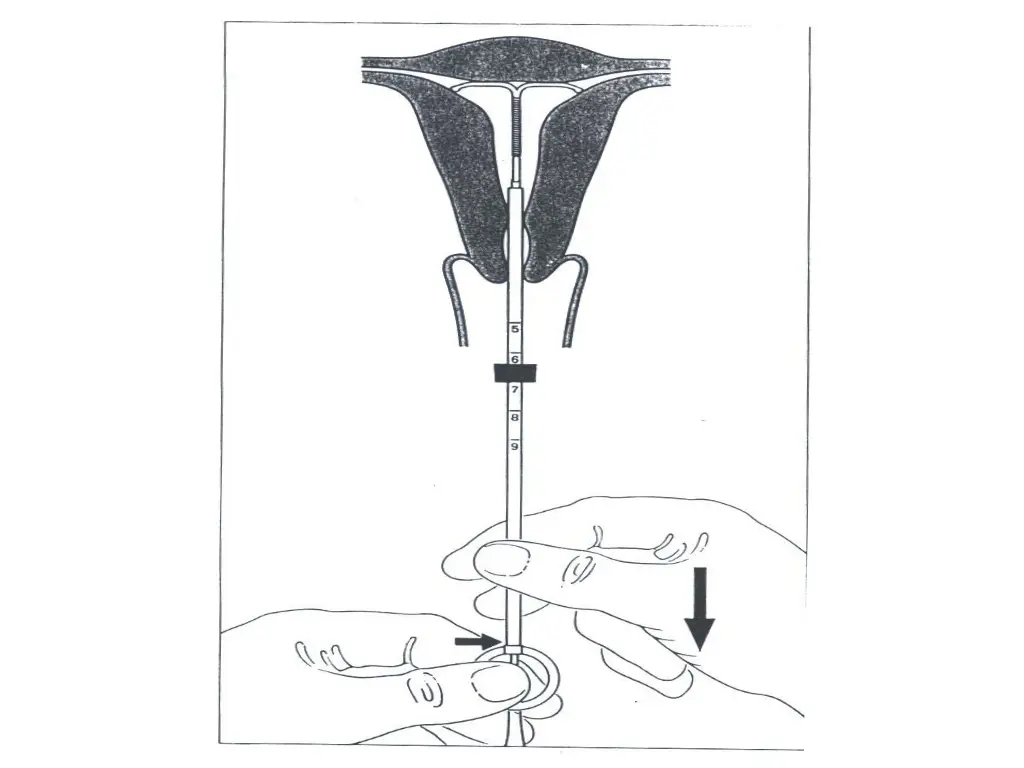slide22