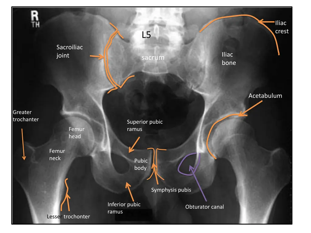 iliac crest