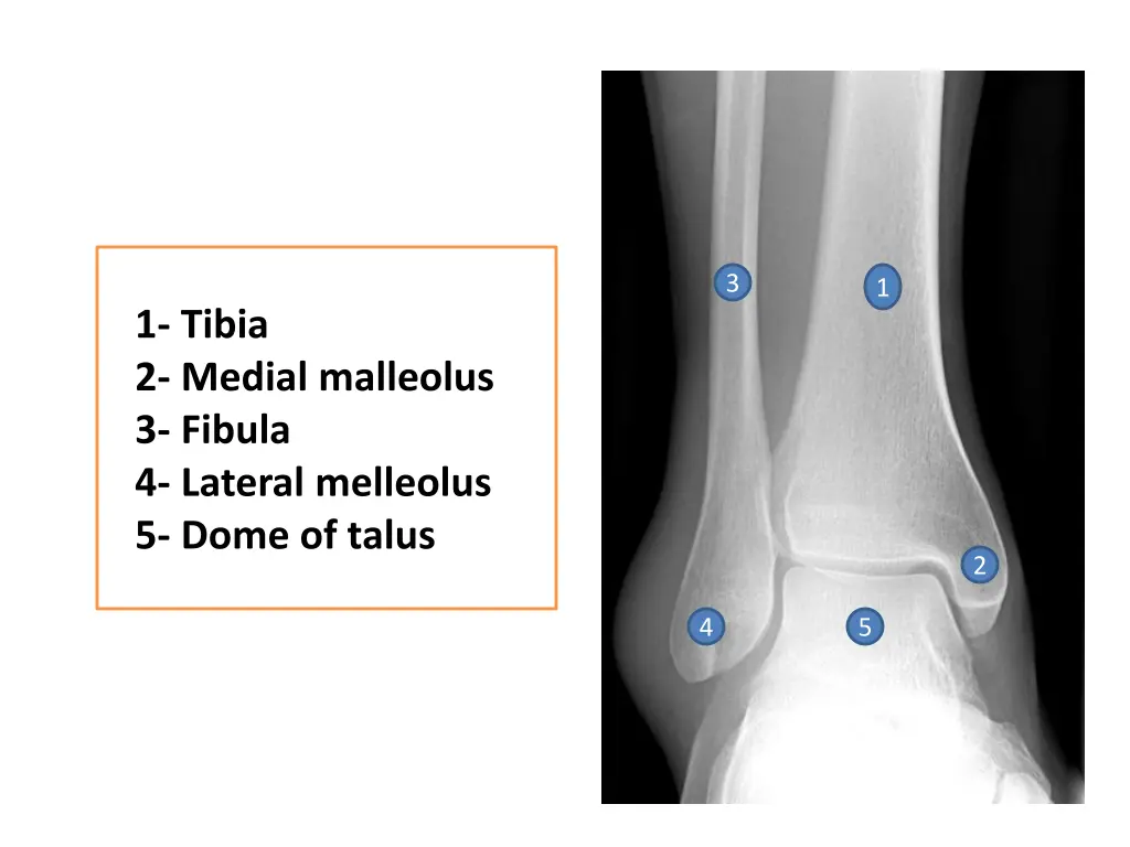 slide12