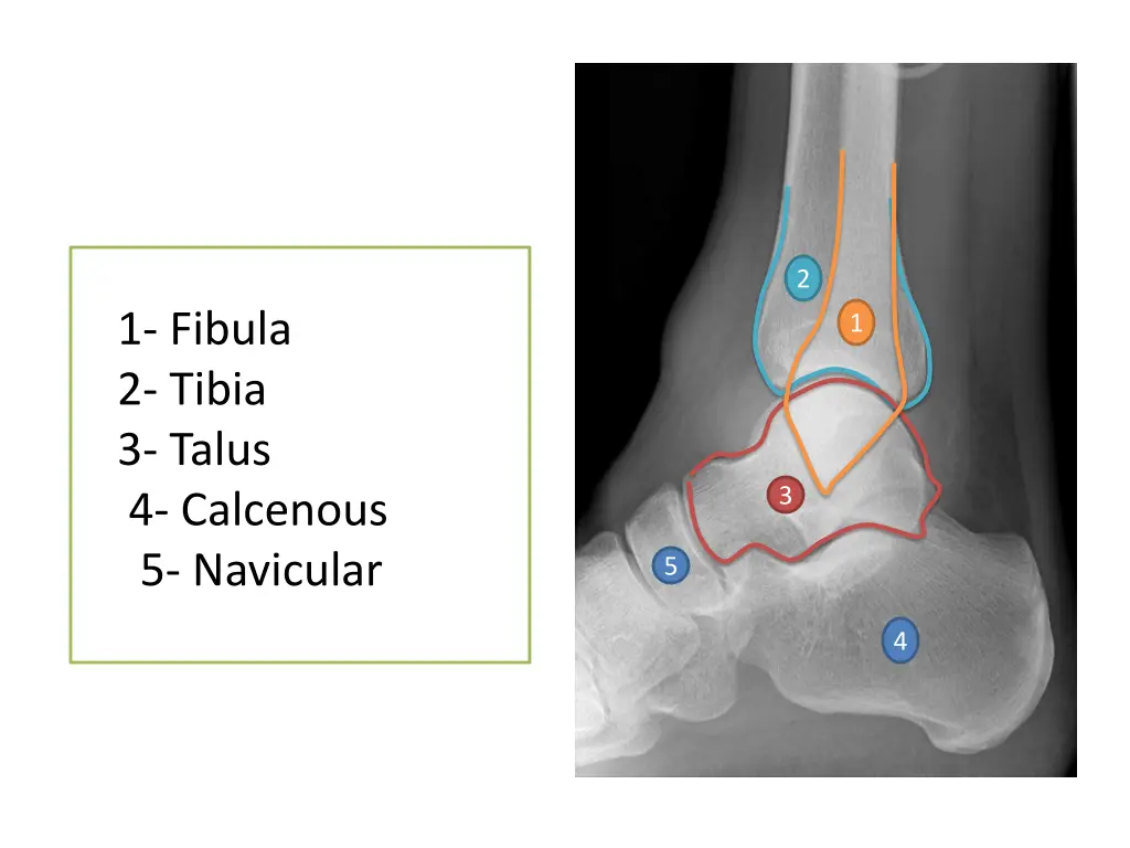 slide13