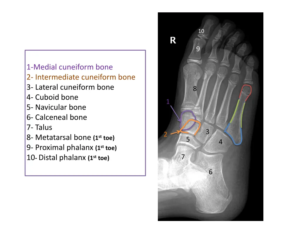 slide15