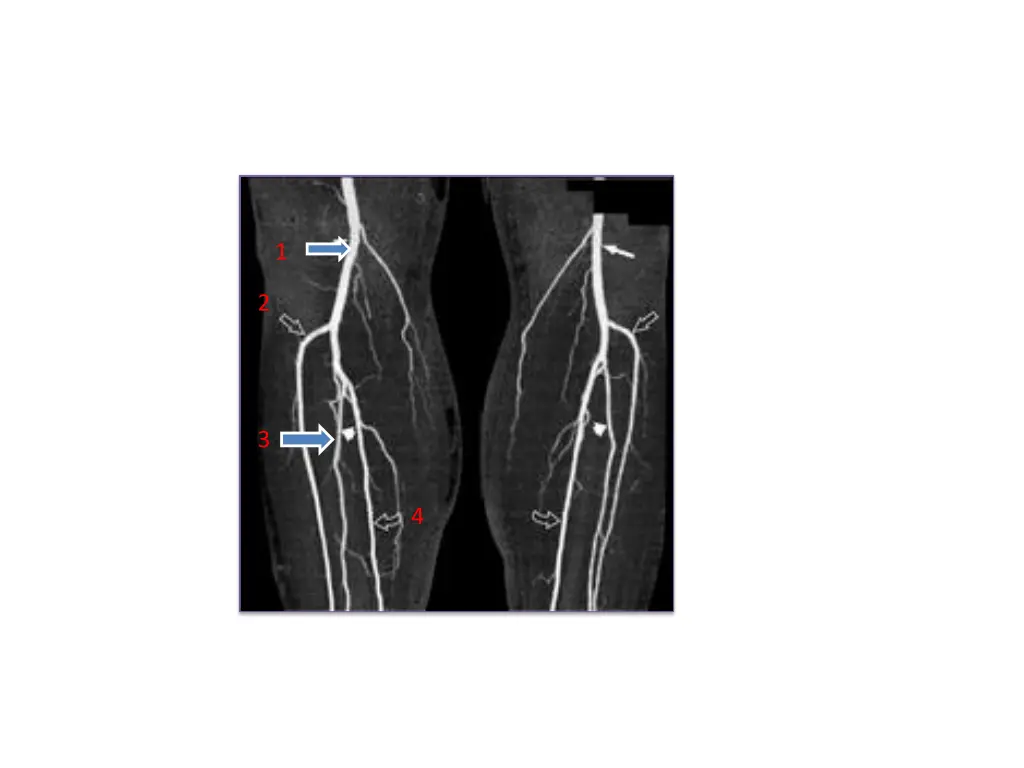 slide19