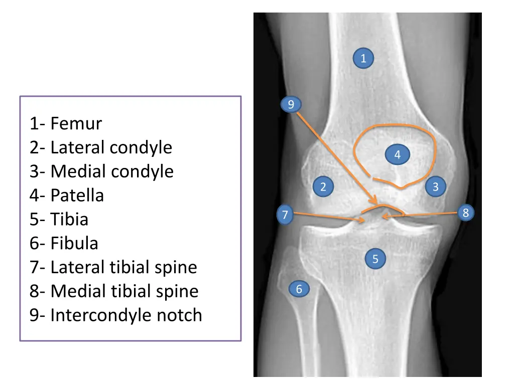 slide8