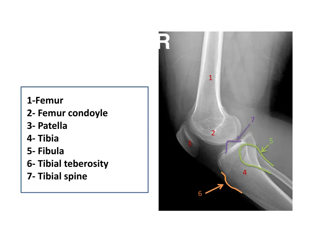 slide9