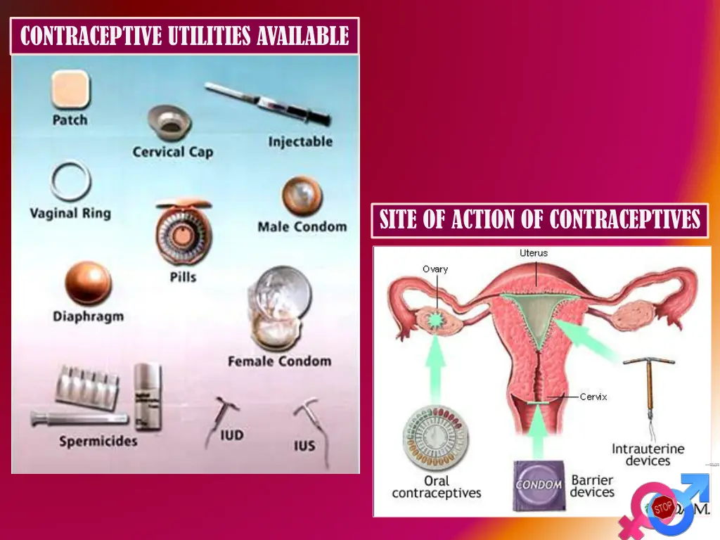 contraceptive utilities available