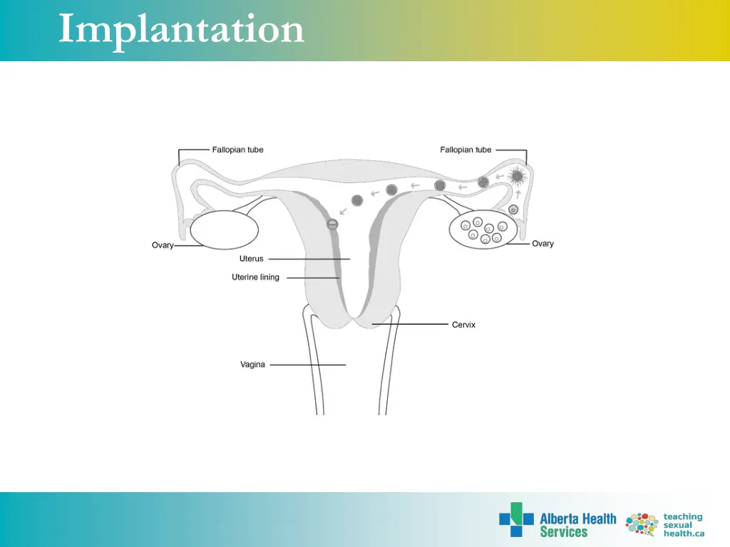 implantation