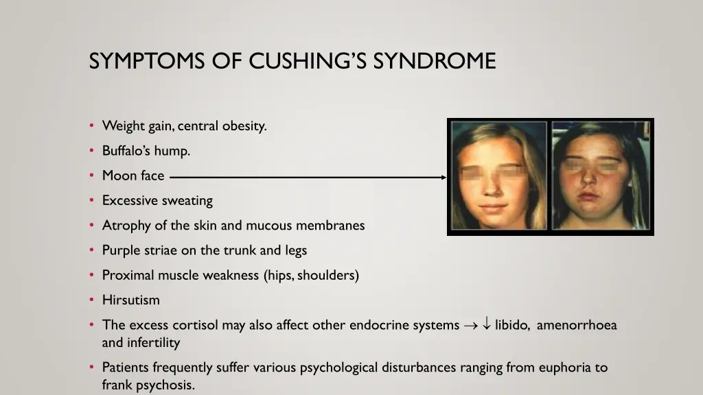 symptoms of cushing s syndrome