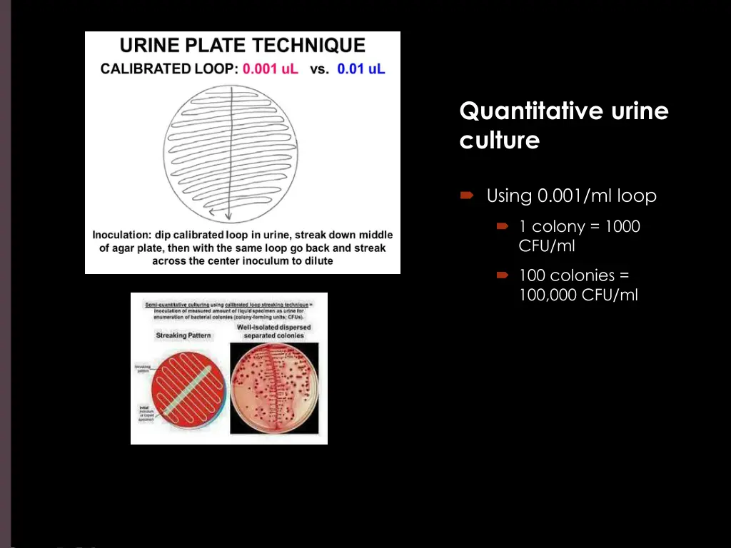 quantitative urine culture