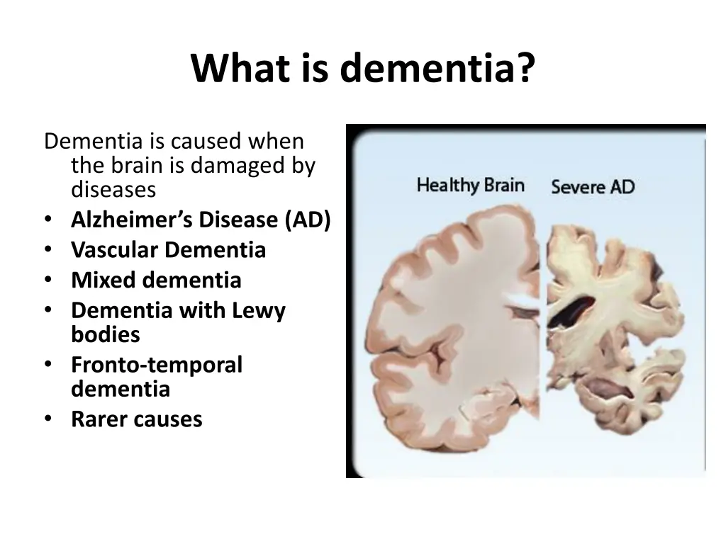 what is dementia