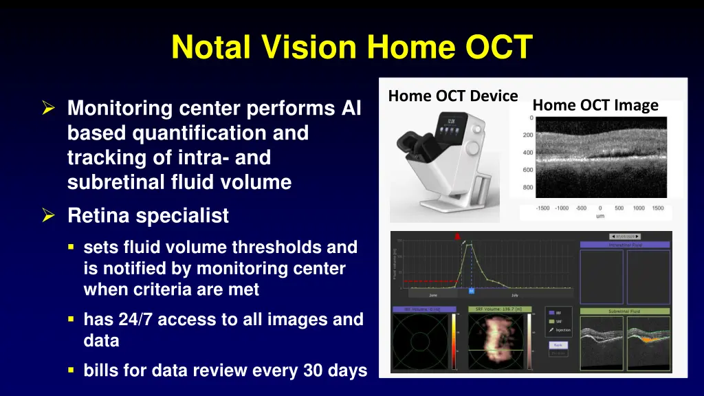 notal vision home oct 1
