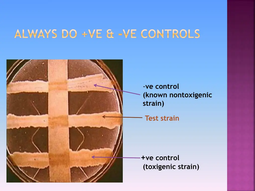 always do ve ve controls
