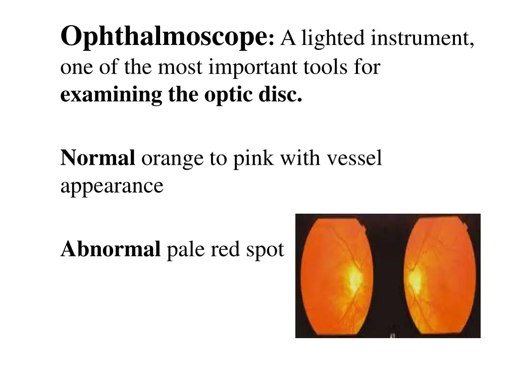 ophthalmoscope a lighted instrument