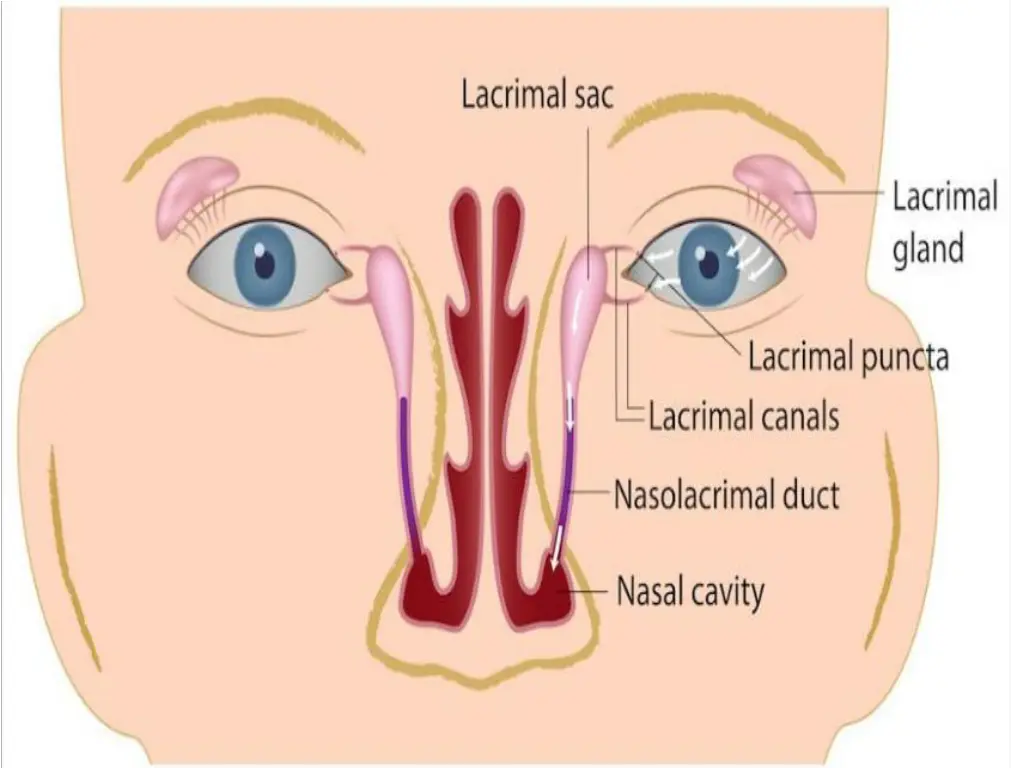 slide11