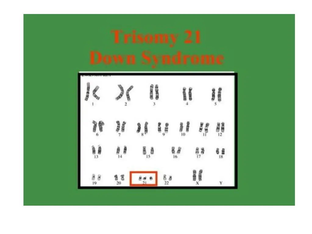 slide17