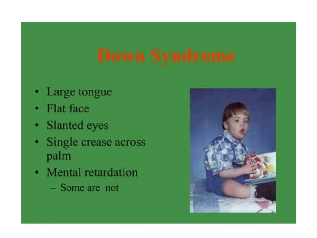slide18
