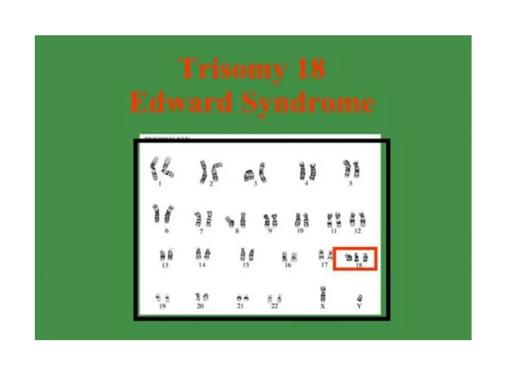 slide19