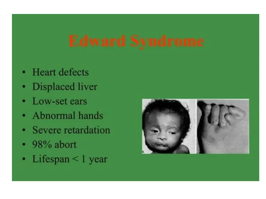slide20