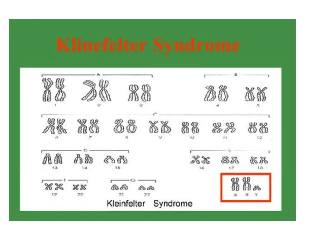 slide23