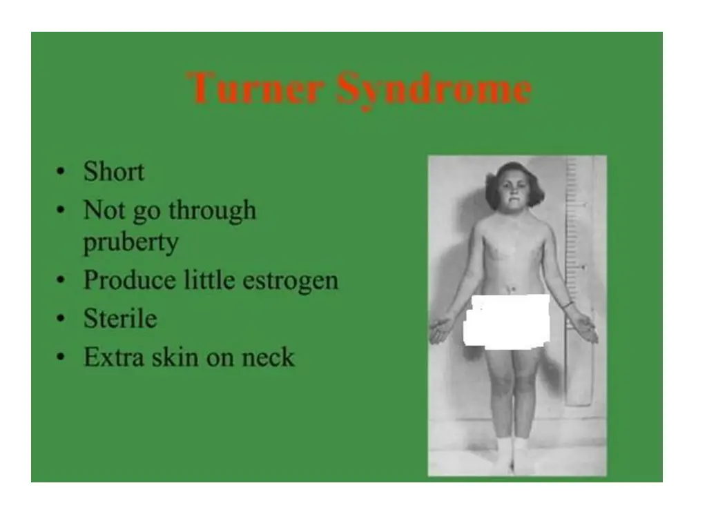 slide26
