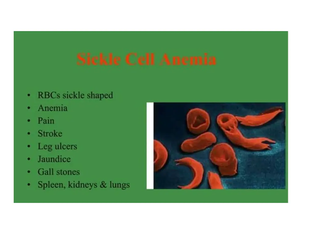slide27