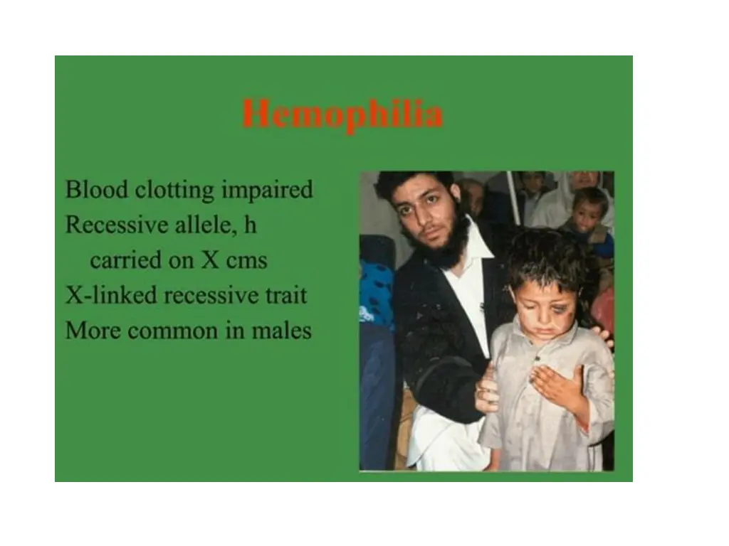 slide29