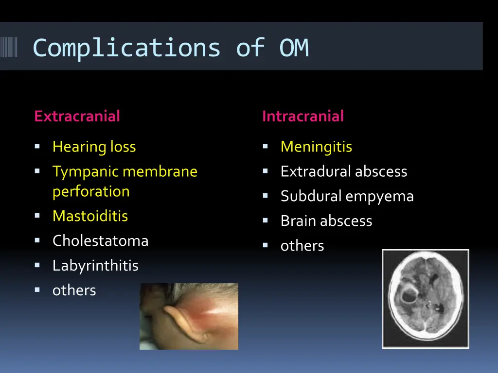 complications of om